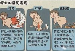孕期屁眼出血（孕期便秘肛门出血是怎么回事的呢）