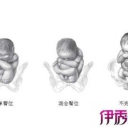 32周胎儿的头在哪里?怀孕32周，臀位怎么办,孕32周胎儿图片真实