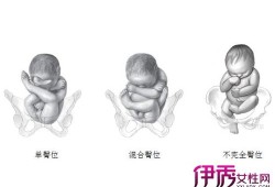 32周胎儿的头在哪里?怀孕32周，臀位怎么办,孕32周胎儿图片真实