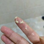 流产后胎儿的DNA在母体内会留存多久,胎儿的排泄物母体怎么排出去