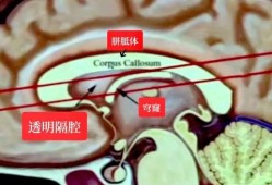 透明隔腔对胎儿的后果是什么啊？很想知道的,胎儿透明隔腔是什么意思