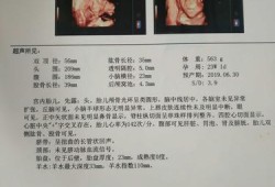 24周胎儿鼻骨正常值是多少,胎儿二十四周发育标准图片