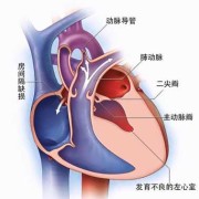 胎儿发育有的心脏为什么会发育不好,胎儿心内膜垫缺损原因有哪些