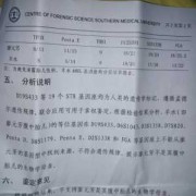亲子鉴定结果准确吗,胎儿亲子鉴定准确率高吗