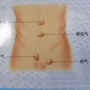胎儿有疝气（小孩疝气的成因?孕检可以检查出来吗）