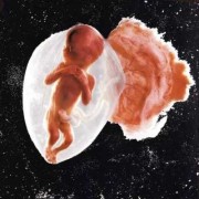 孕18周胎儿在什么位置？18周的胎儿有多大啦,孕期18周胎儿图片大全