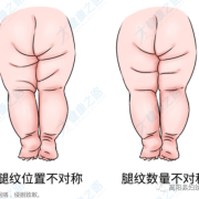 怎么看胎儿腿长不长（怎么看胎儿腿长不长?）