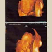 孕期四维照片（孕妇四维照片）