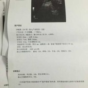 胎儿超声生物物理评分8分（胎儿心跳170正常吗）