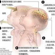 胎儿脑损伤（胎儿脑损伤出生后会出现什么症状）