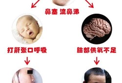 鼻窦炎对胎儿有影响吗（鼻窦炎对胎儿有影响吗）
