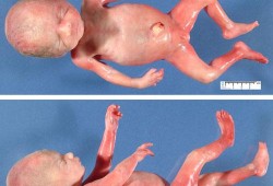 十五周的胎儿是什么样的,怀孕5个月胎儿彩超男宝图