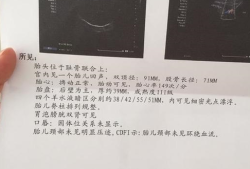 孕晚期胎儿偏小两周怎么办（孕36周b超偏小两周该怎么办，医生建议我多吃点东西，但是我真的没胃口啊）