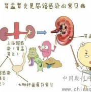 备孕期间尿道炎怎么办（尿路感染会影响怀孕吗）