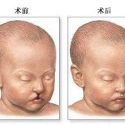 二维b超能排畸兔唇吗,胎儿二维b超图怎么看