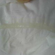怀孕期间水样白带（怀孕六个月有水样白带，平时分泌物发黄怎么办）