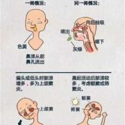 孕期鼻炎鼻塞怎么办,怀孕期间鼻塞严重怎么办