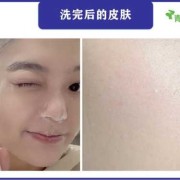 孕妇可以用洗面奶吗，会不会用了对身体有什么影响呢,孕期用洗面奶洗脸对胎儿有影响吗
