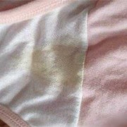 孕期下面总是湿的（孕期下面总是湿的正常吗）