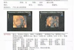 如何看四维单上的数据,四维彩超如何看胎儿性别