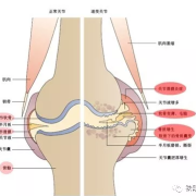孕期膝盖疼是怎么回事（孕期膝盖疼是怎么回事 女性）