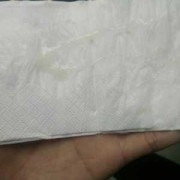 孕中期白带多正常吗,