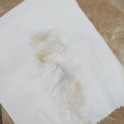 怀孕期间见红（怀孕期间见红是什么原因）