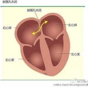 胎儿心脏卵圆孔正常值（胎儿心脏卵圆孔正常值是多少?）