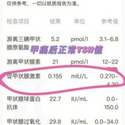 单纯tsh高对胎儿的影响（单纯tsh高对胎儿的影响大吗）