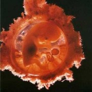 怀孕五个月胎动怎么样？怀孕几个月，胎动会有规律,怀孕5个月胎儿多大图片