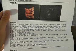 胎儿双肾肾盂分离（四维彩超中宝宝双肾盂分离是什么意思）