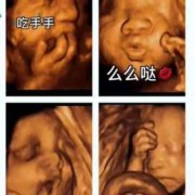 胎儿拳打脚踢是男孩子（胎儿拳打脚踢是男孩子）