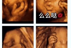 胎儿拳打脚踢是男孩子（胎儿拳打脚踢是男孩子）