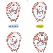 胎儿脐带绕颈一周图片（脐带绕颈一周的文案）