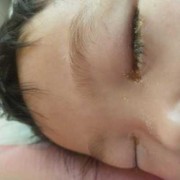 6个月胎儿图片（宝宝6个月了，眼睛还是有很多眼屎，怎么回事）