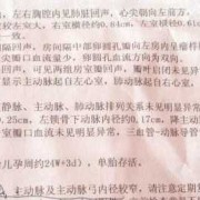 超声胎儿诊断（超声胎儿诊断怎么写）