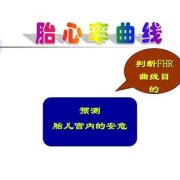 Fhr是胎儿的什么意思（fhr是胎儿的什么意思165）