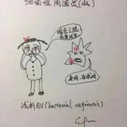 孕妇念珠菌性阴道炎怎么办,孕期念珠菌性阴炎会影响胎儿吗