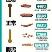 大便很粗是什么原因怎么办,孕期大便粗大是什么原因