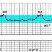 胎儿心跳加快（胎心快是什么原因）