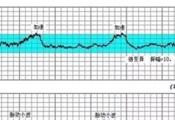 胎儿心跳加快（胎心快是什么原因）