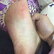 孕妇脚酸,孕期眼酸是怎么回事