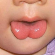 胎儿伸舌头（婴儿经常吐舌头是怎么回事）