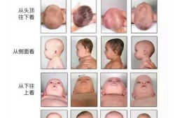 胎儿头偏下（胎儿头偏下有什么影响）
