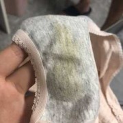 孕期白带发黑怎么回事