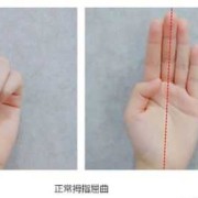 大排畸婴儿手握拳状态请问正常吗,胎儿小拳头滑来滑去男孩还是女孩啊