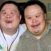 唐氏综合症有生育能力吗,唐氏症胎儿是什么引起的