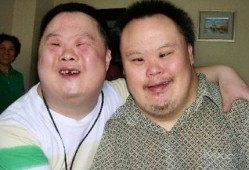 唐氏综合症有生育能力吗,唐氏症胎儿是什么引起的