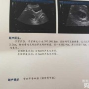 胎儿为什么会没有胎心（胎儿为什么会没有胎心胎芽）