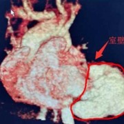 胎儿坏死是什么原因（胎儿坏死是什么原因造成的）
